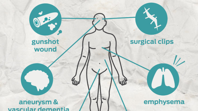 Exclusive Autopsy Archive: Final Reports