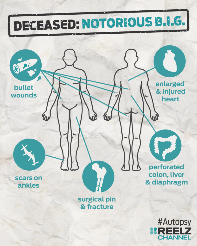autopsy_infographic_notoriousbig_blank